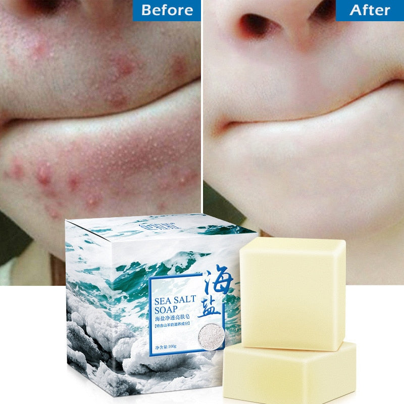 100g Sea Salt Soap Cleaner Removal Pimple Pores Acne Treatment Goat Milk Moisturizing Face Care Wash Basis For Soap Hot Fashion